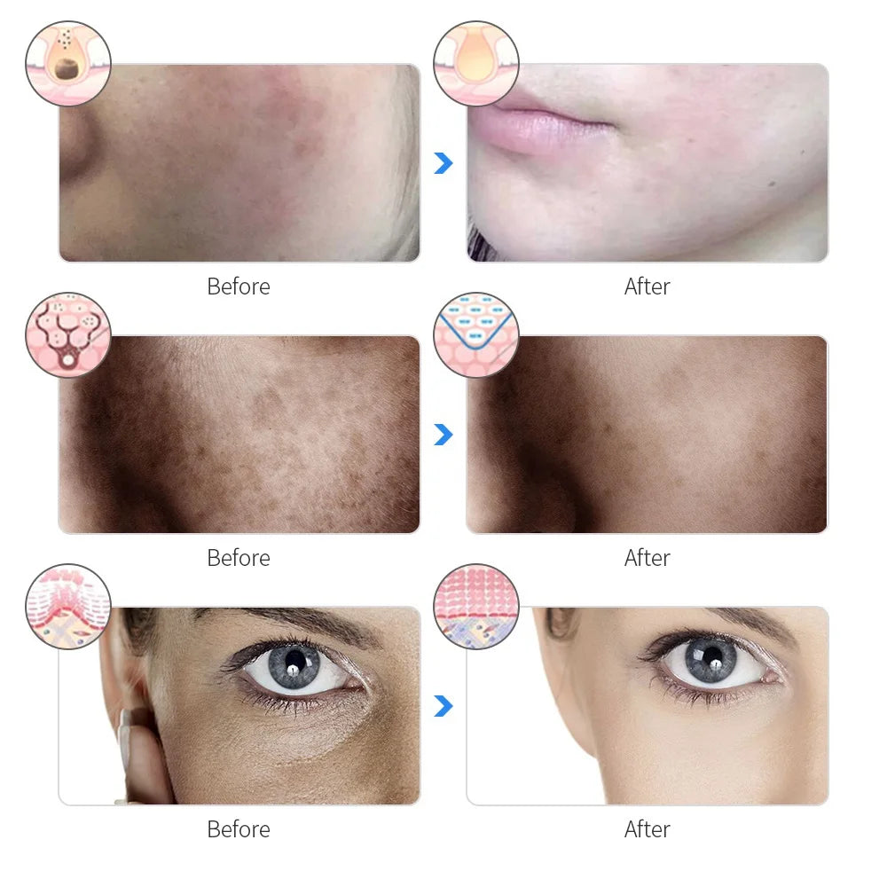 For You™ Beauty Mask