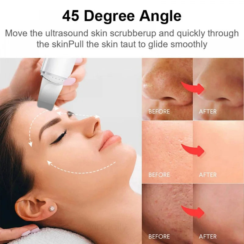 For You™ Cavitation shovel Facial Exfoliation