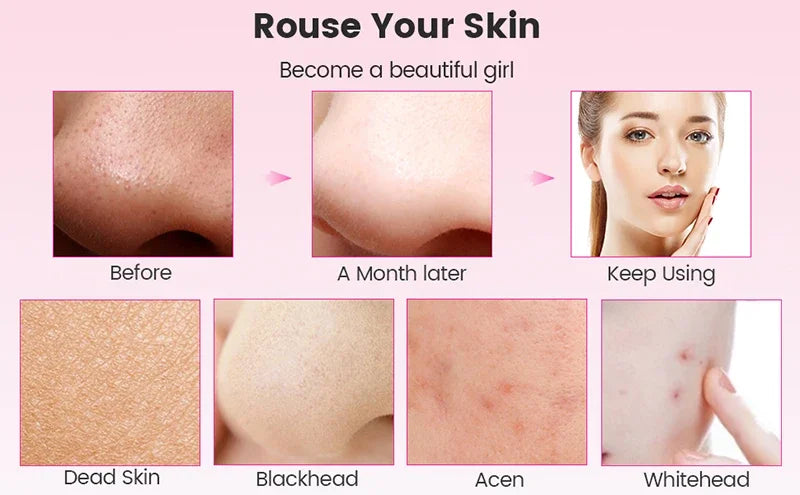 For You™ Cavitation shovel Facial Exfoliation
