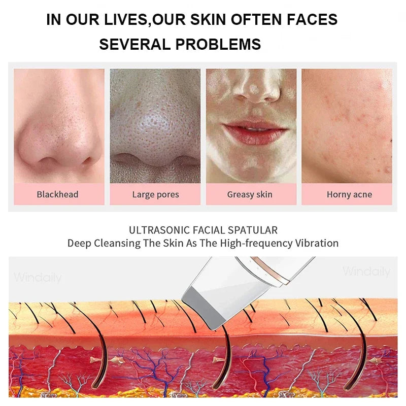 For You™ Cavitation shovel Facial Exfoliation