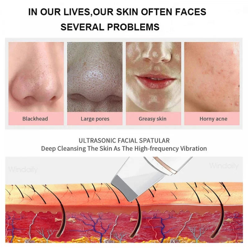 For You™ Cavitation shovel Facial Exfoliation