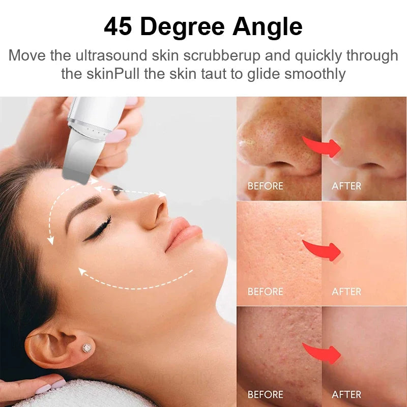 For You™ Cavitation shovel Facial Exfoliation