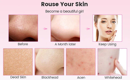 For You™ Cavitation shovel Facial Exfoliation